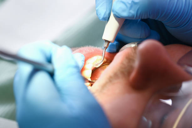 Best Emergency Dental Care for Sports Injuries in Blue Springs, MO